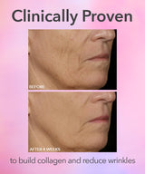 DRx SpectraLite™ FaceWare Pro 3-Minute LED Device