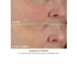 Advanced Retinol and Ferulic Perfectly Dosed Treatment